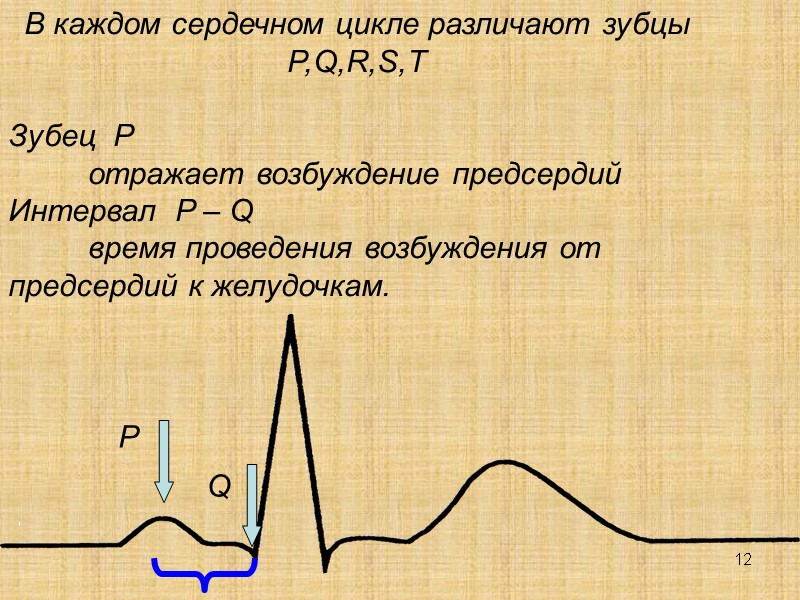 12 В каждом сердечном цикле различают зубцы  P,Q,R,S,T  Зубец  P 